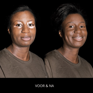 keromask voor na donkere huidtint